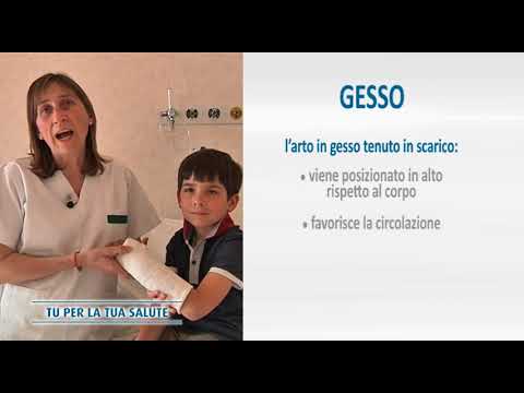 10 strategie per sopravvivere al fastidioso gesso al braccio